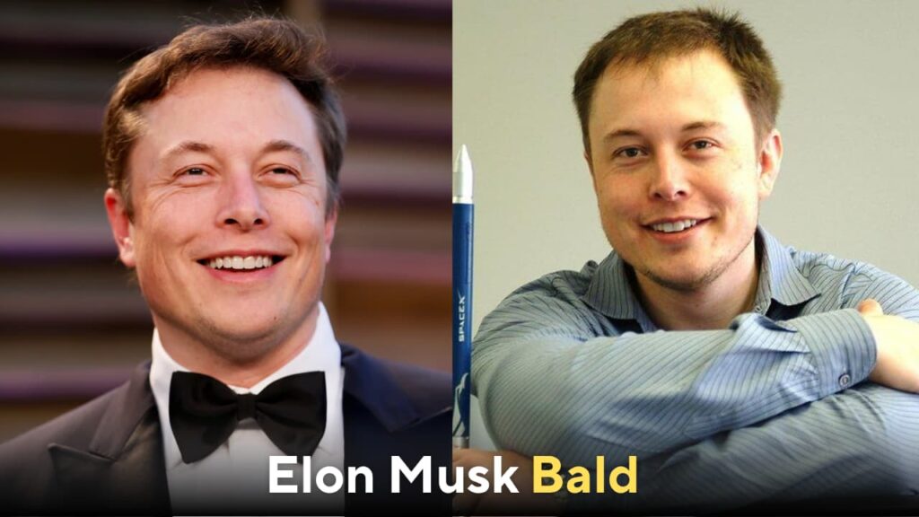 elon musk bald