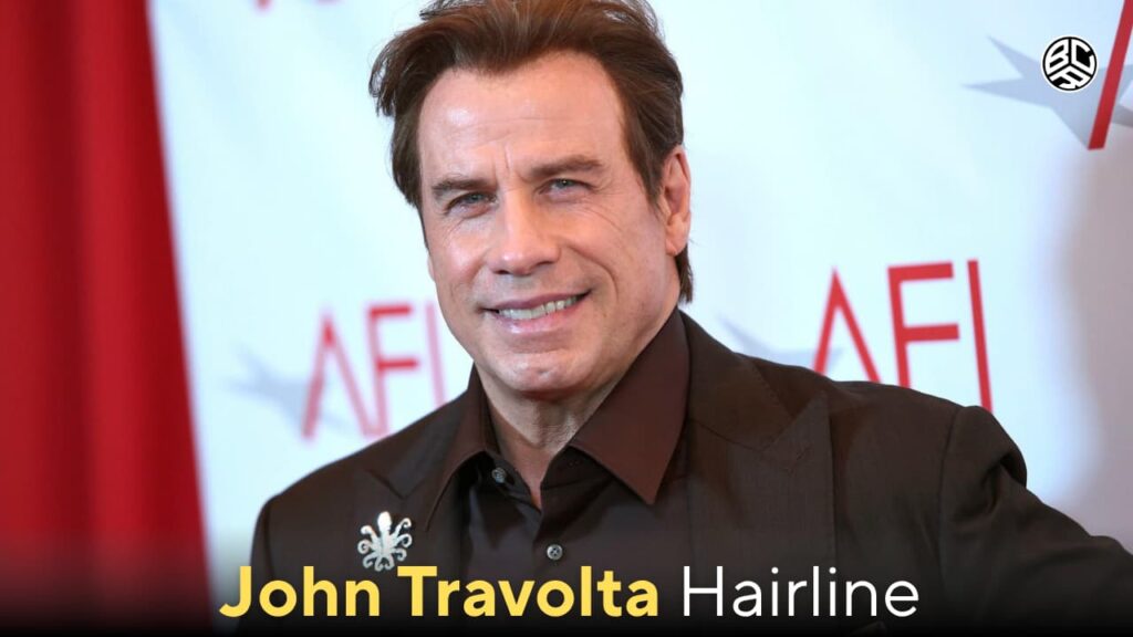 john travolta hairline