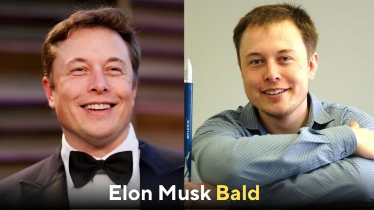 elon musk bald