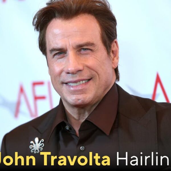 John Travolta Hairline: The Real Story Behind His Changing Look