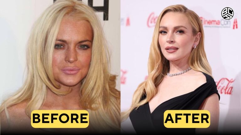 lindsay lohan before and after plastic surgery