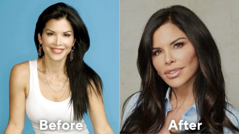 lauren sanchez plastic surgery before and after