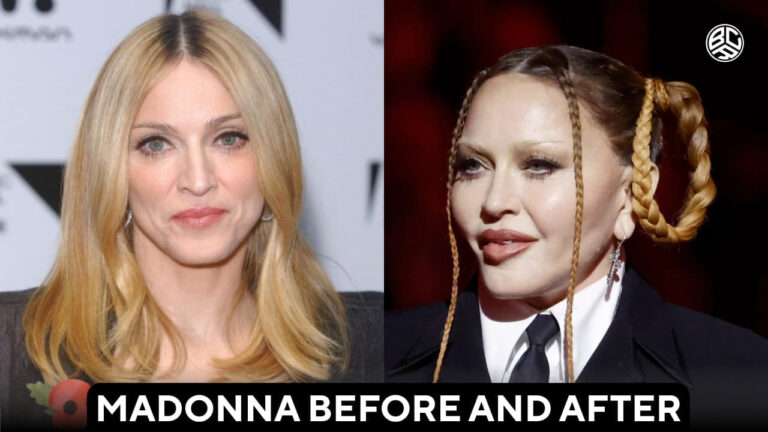 madonna before and after